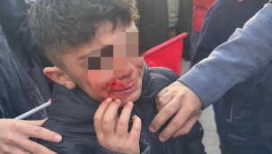 İmamoğlu'ndan Provokasyon Açıklaması 